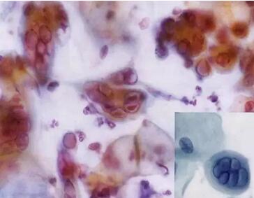 ���(l��i)ϴ���ӣ��������ךW���M(j��n)�ھ�ϴ�O(sh��)���ꑌ�������Ҽ�